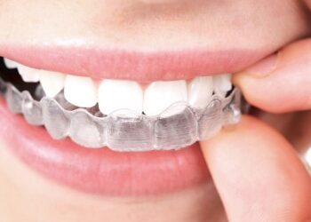 alineadores dentales